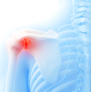 어깨에 발생하는 대표적인 질환 이미지