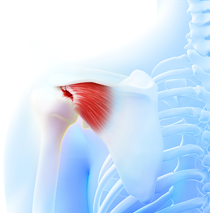 어깨에 발생하는 대표적인 질환 이미지