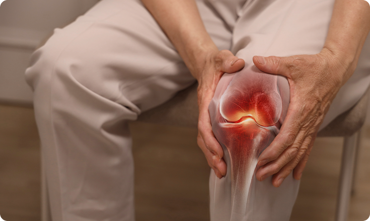 근본정형외과의원무릎 질환의 주요원인