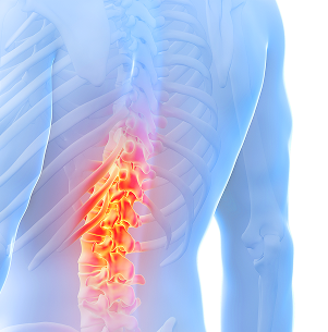 목, 허리에 발생하는 대표적인 질환 이미지