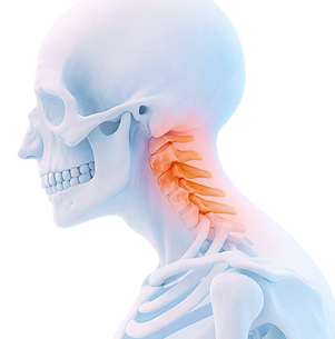 목, 허리에 발생하는 대표적인 질환 이미지